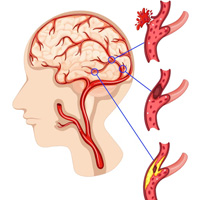 neurosurgeons in India