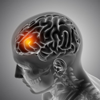 neurosurgeons in India