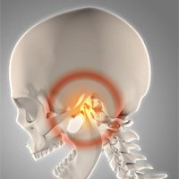 neurosurgeons in India