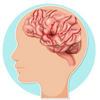 neurosurgeons in India