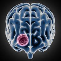 neurosurgeons in India