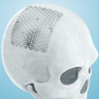 neurosurgeons in India