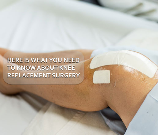 Here is what you need to know about knee replacement surgery