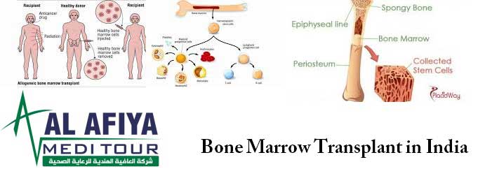 Bone Marrow Transplant (BMT) in India: A New Era of Medical Perfection