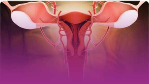 Ovarian cancer treatment in India