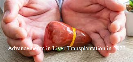 Advancements in Liver Transplantation in 2023