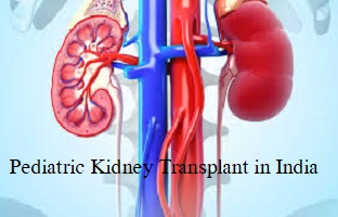 Pediatric Kidney Transplant in India