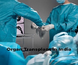 Organ Transplant in India at Affordable Cost