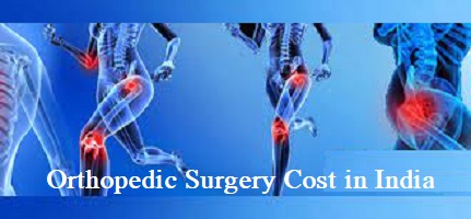 Orthopedic Surgery Types and Treatment Cost